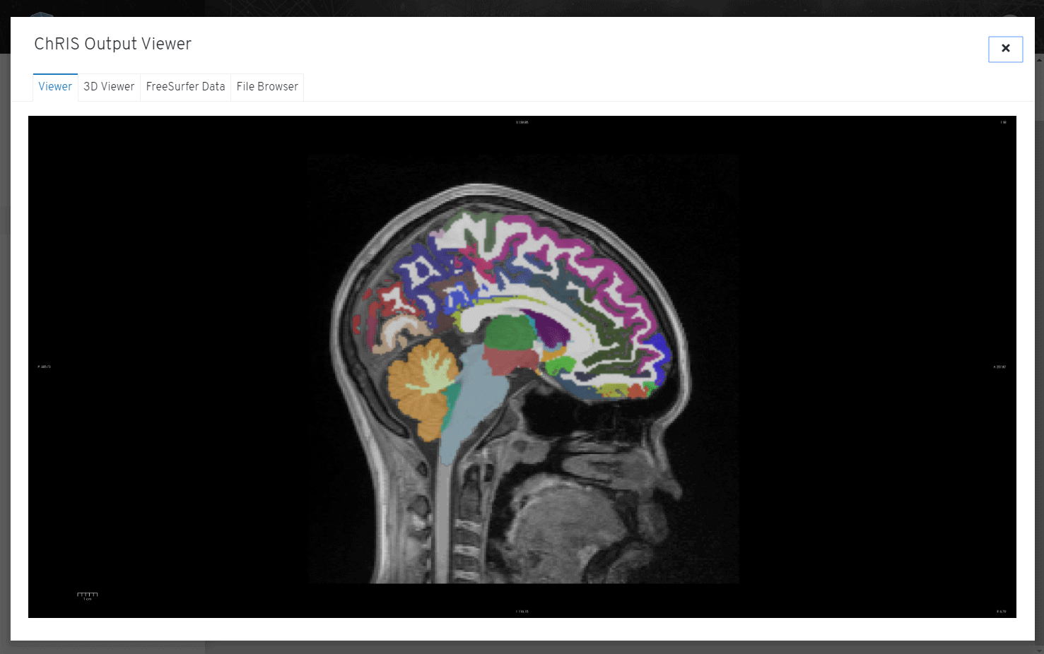 Free Surfer Plugin 2D Output